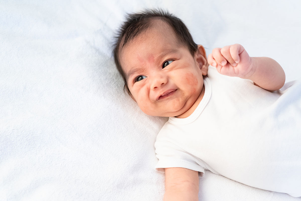 Phát hiện sớm dấu hiệu trẻ không hợp sữa công thức và tìm giải pháp xử lý hiệu quả